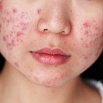 Bagaimana Suatu Produk dapat dikatakan sebagai Krim Wajah Aman BPOM? Bagaimana Suatu Produk dapat dikatakan sebagai Krim Wajah Aman BPOM?