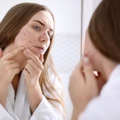 Rangkaian Skincare untuk Menghilangkan Jerawat Rangkaian Skincare untuk Menghilangkan Jerawat