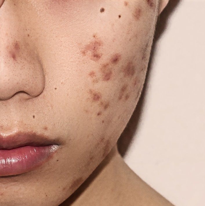 4 Tips Sederhana Memilih Cream Aman untuk Wajah 4 Tips Sederhana Memilih Cream Aman untuk Wajah