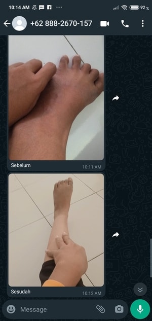 -