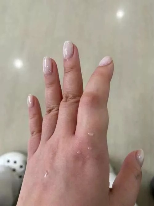 -